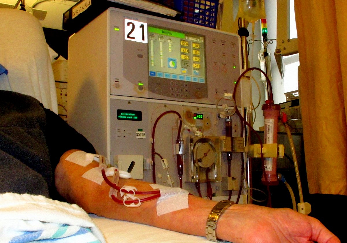 Arm of patient receiving dialysis from the American Kidney Fund 